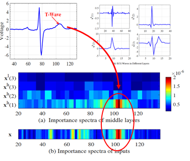 The classification results of mWDN-based deep neural networks are interpretable. In the example, the proposed model detects heart diseases from ECG series based on the anomalies in the highest frequent component of T-Wave.